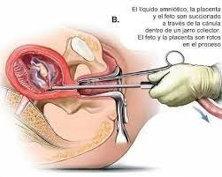 Templo satánico crea clínica para realizar abortos